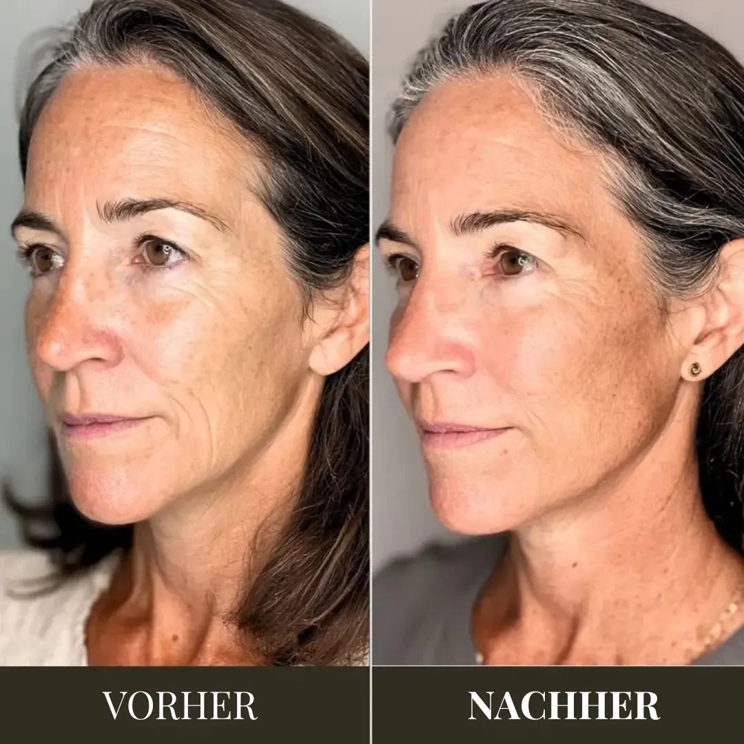 AGE-R Booster Pro – Koreanisches Beauty-Gerät für strahlende Haut