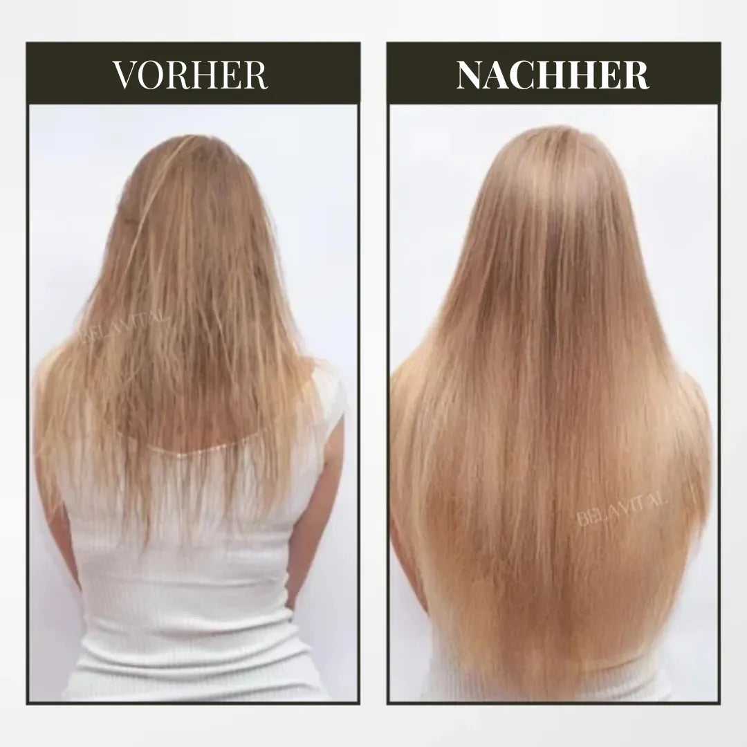 BreoBrush Licht-Therapie-Kamm: Massage & Diffusor für Haarwachstum