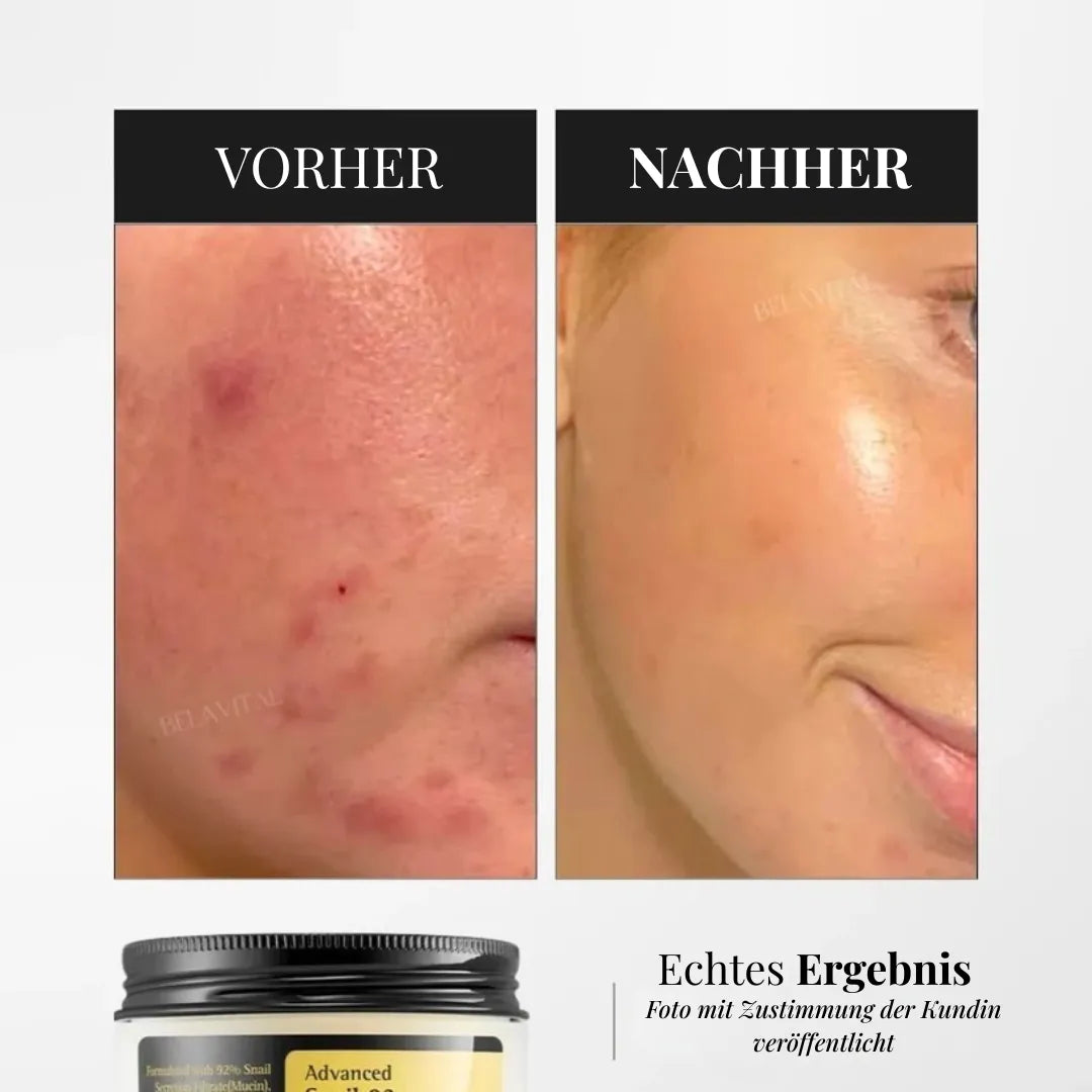 Koreanischer Schneckenschleim-Creme – Regeneration & Anti-Aging
