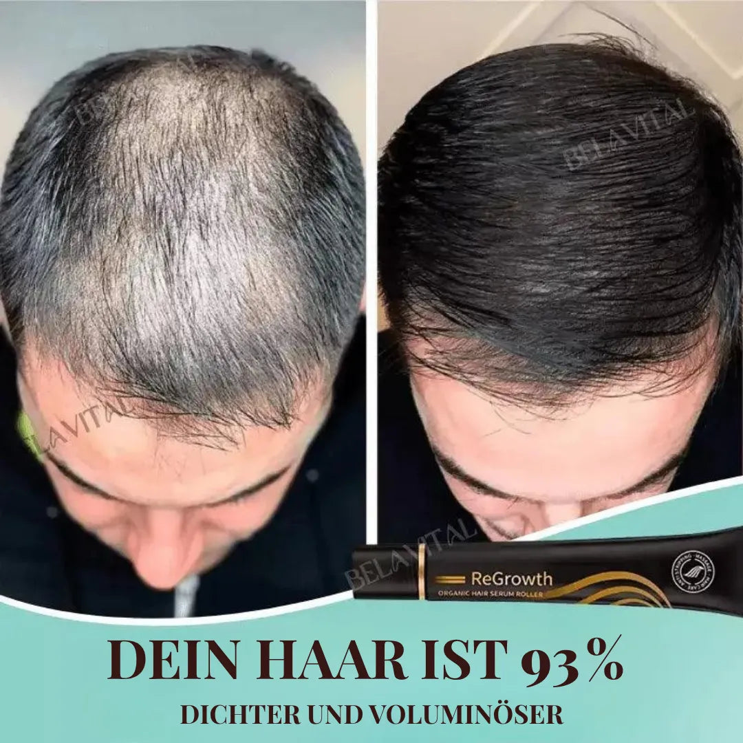Repair Hair Pro+ Set mit Gratisgeschenk: Die Komplettlösung gegen Haarausfall und beginnende Glatze