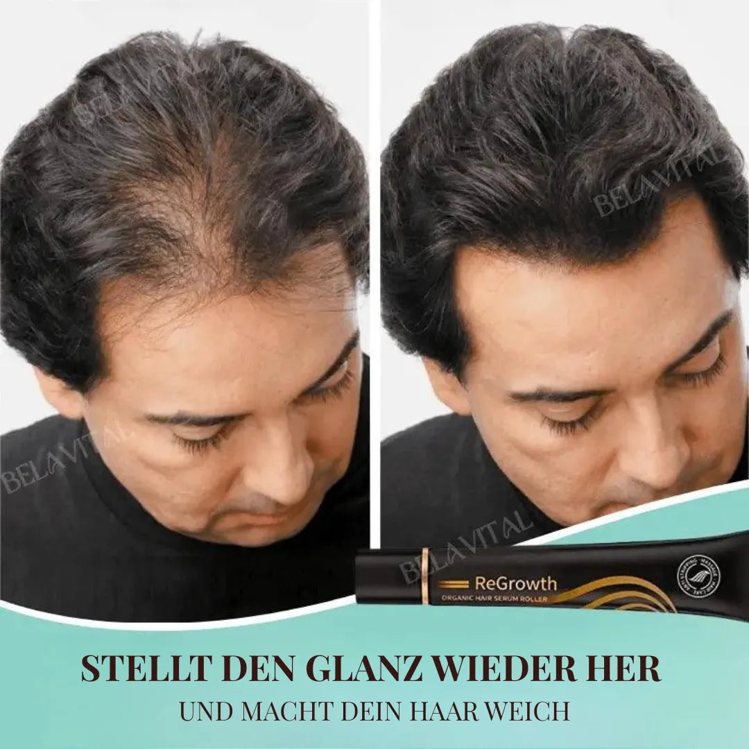 Repair Hair Pro+ Set mit Gratisgeschenk: Die Komplettlösung gegen Haarausfall und beginnende Glatze