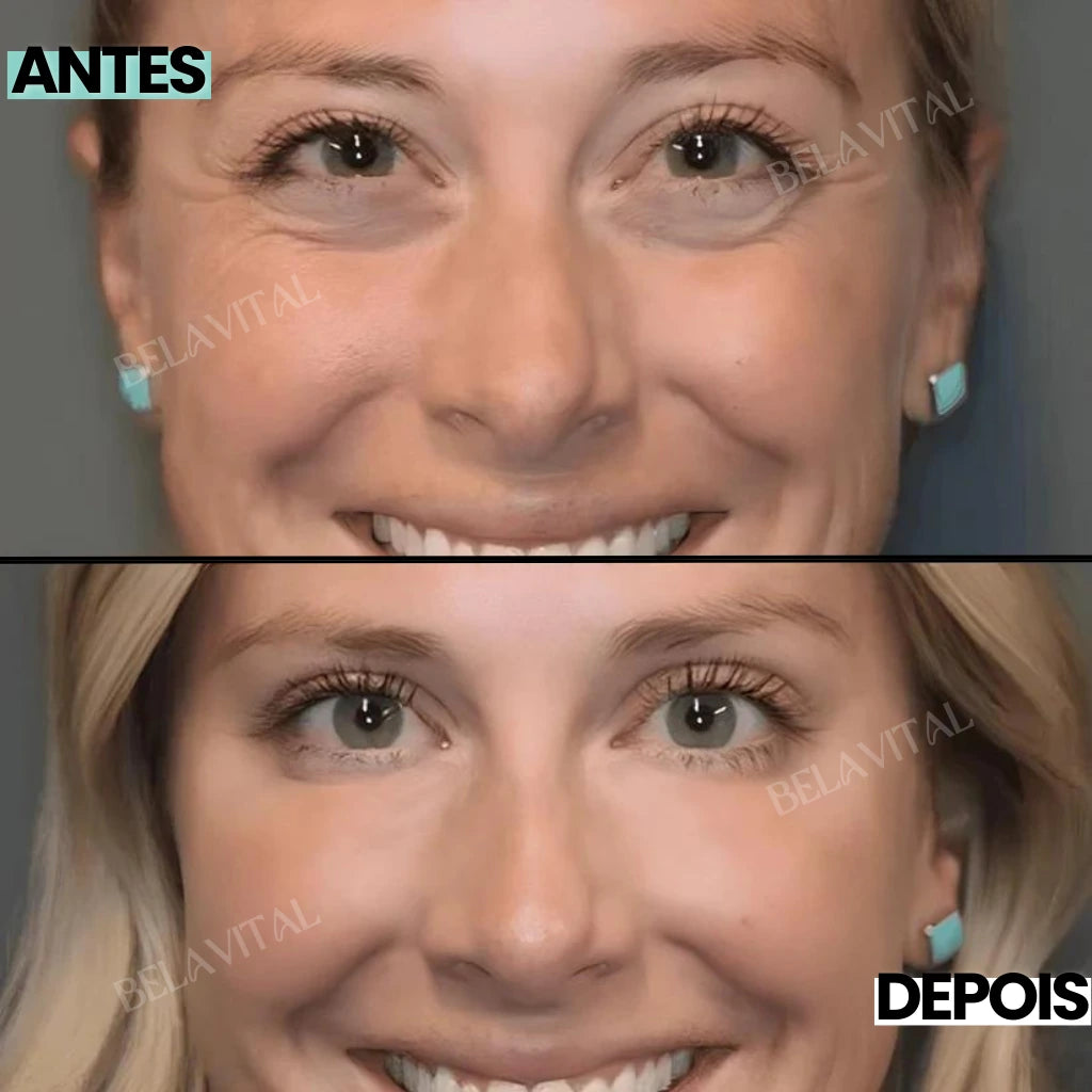 Celyn – Augencreme gegen Augenringe & für strahlende, glatte Haut