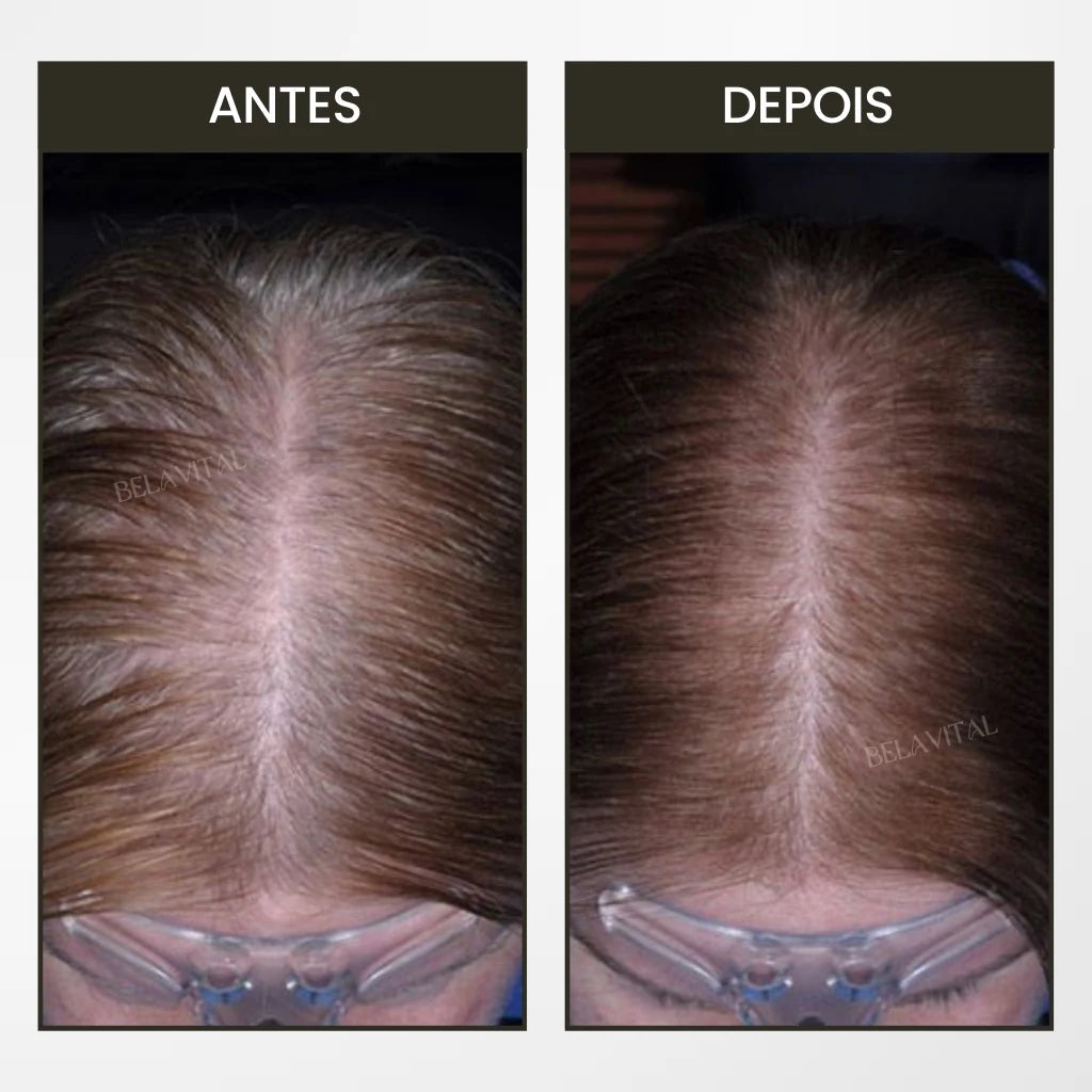 BreoBrush Licht-Therapie-Kamm: Massage & Diffusor für Haarwachstum