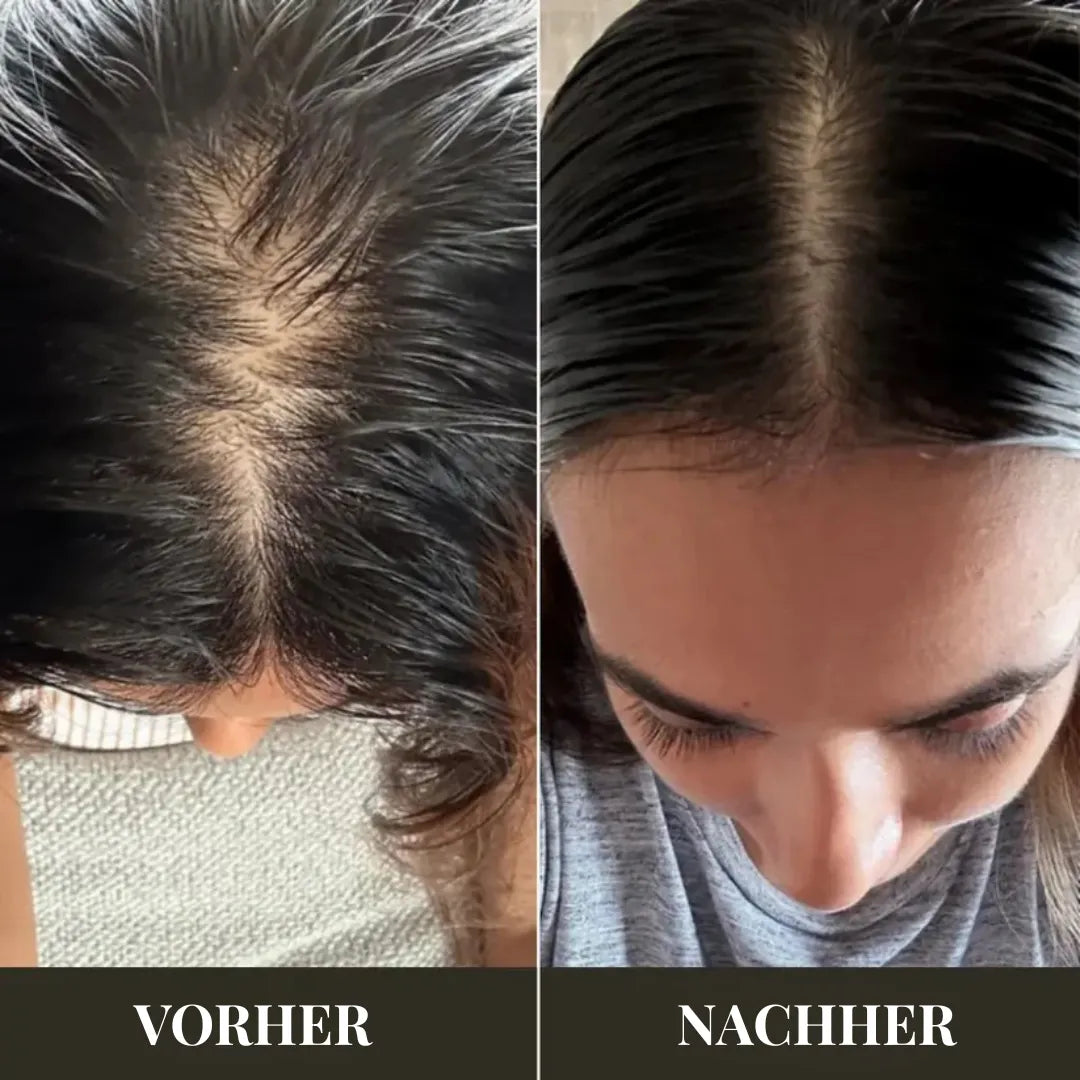 Elektrische Kopfhaut-Massagebürste – Haarwachstum & Entspannung