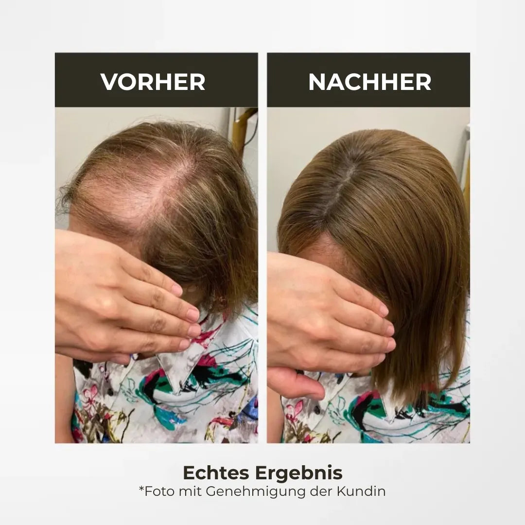 Top Closure – Natürlicher Haaransatz mit Pony 50 cm Welle | Für Haarausfall & lichte Stellen