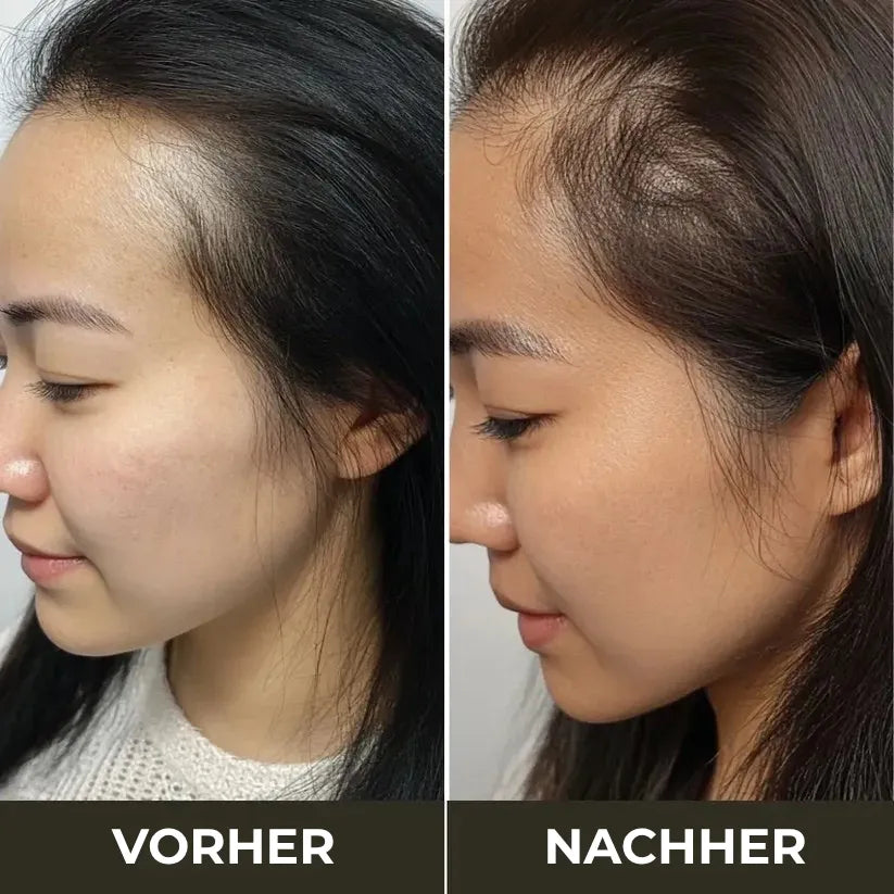 TheraBrush 4-in-1 – Anti-Haarausfall Bürste mit Licht-, Massage- & Aromatherapie