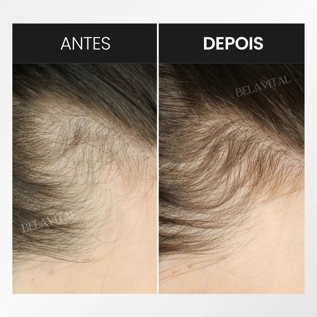 Premium-Haarpflege-Kit – Für kräftiges Haarwachstum & weniger Haarausfall