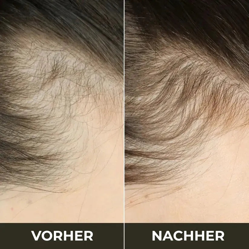 TheraBrush 4-in-1 – Anti-Haarausfall Bürste mit Licht-, Massage- & Aromatherapie
