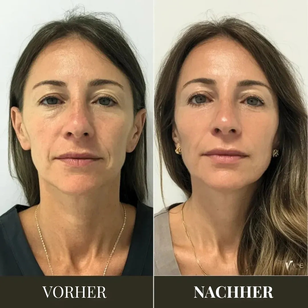 AGE-R Booster Pro – Koreanisches Beauty-Gerät für strahlende Haut