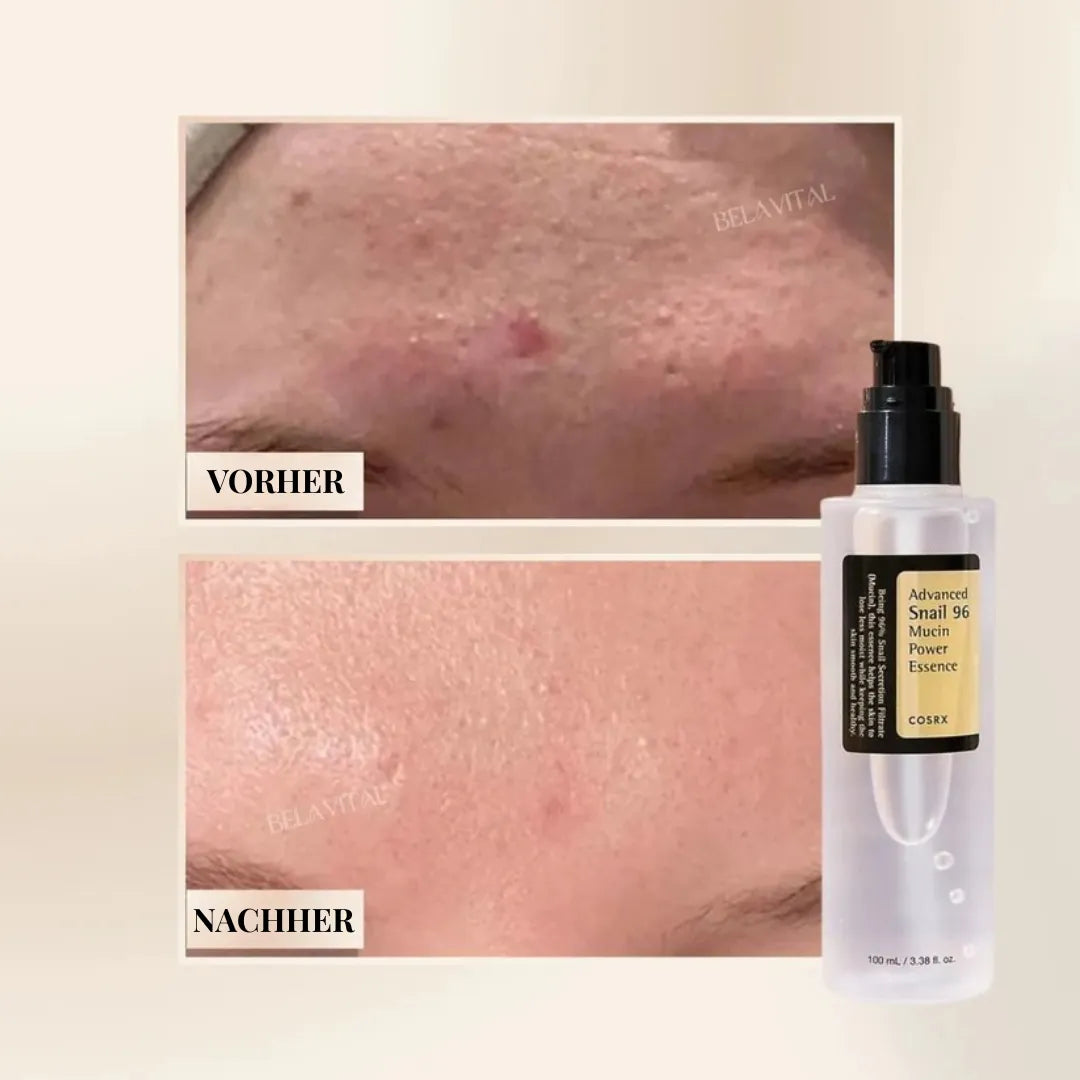 Advanced Snail 96 Serum | Koreanisches Hautpflege-Wunder mit 96 % Schneckenschleim
