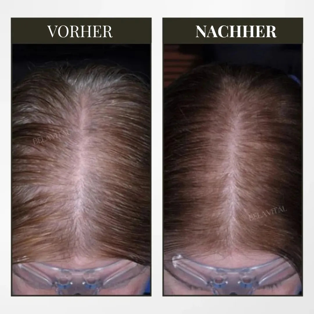 BreoBrush Licht-Therapie-Kamm: Massage & Diffusor für Haarwachstum