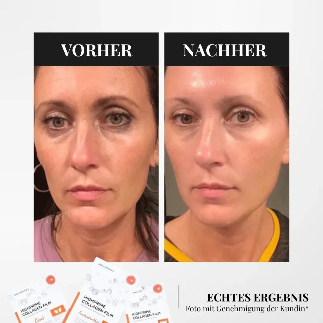 GoldBotox Highprime Kollagen-Masken-Set – Straffende Pflege mit Soforteffekt