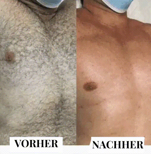 Kristall-Haarentferner von BelaVital – Sanft, Wiederverwendbar & Hautschonend