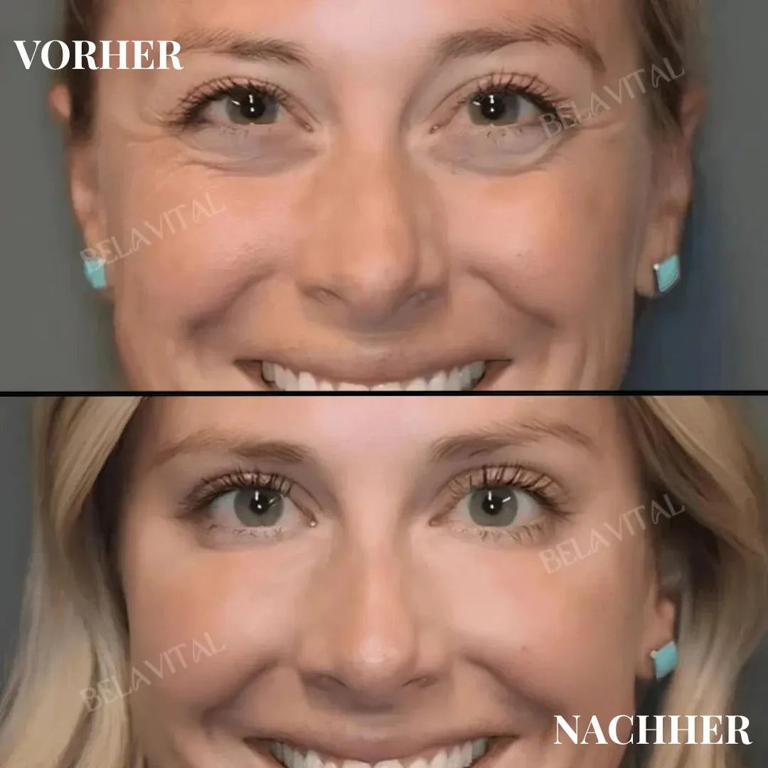 LED-Gesichtsmassager mit Lifting-Effekt – Gegen Falten & Doppelkinn