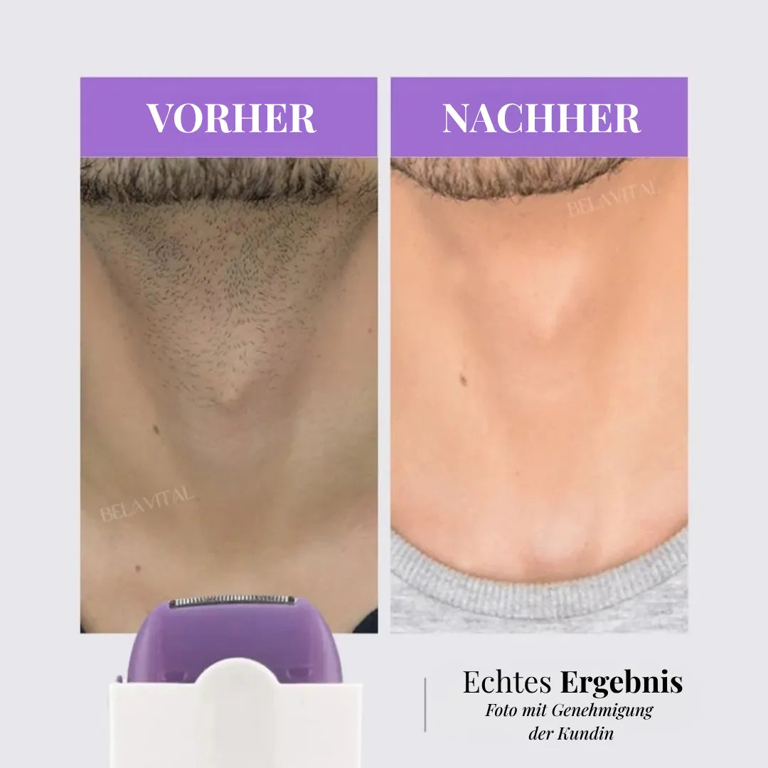 LaserFlex Haarentferner – Schmerzfreie Depilation + Gratisgeschenk