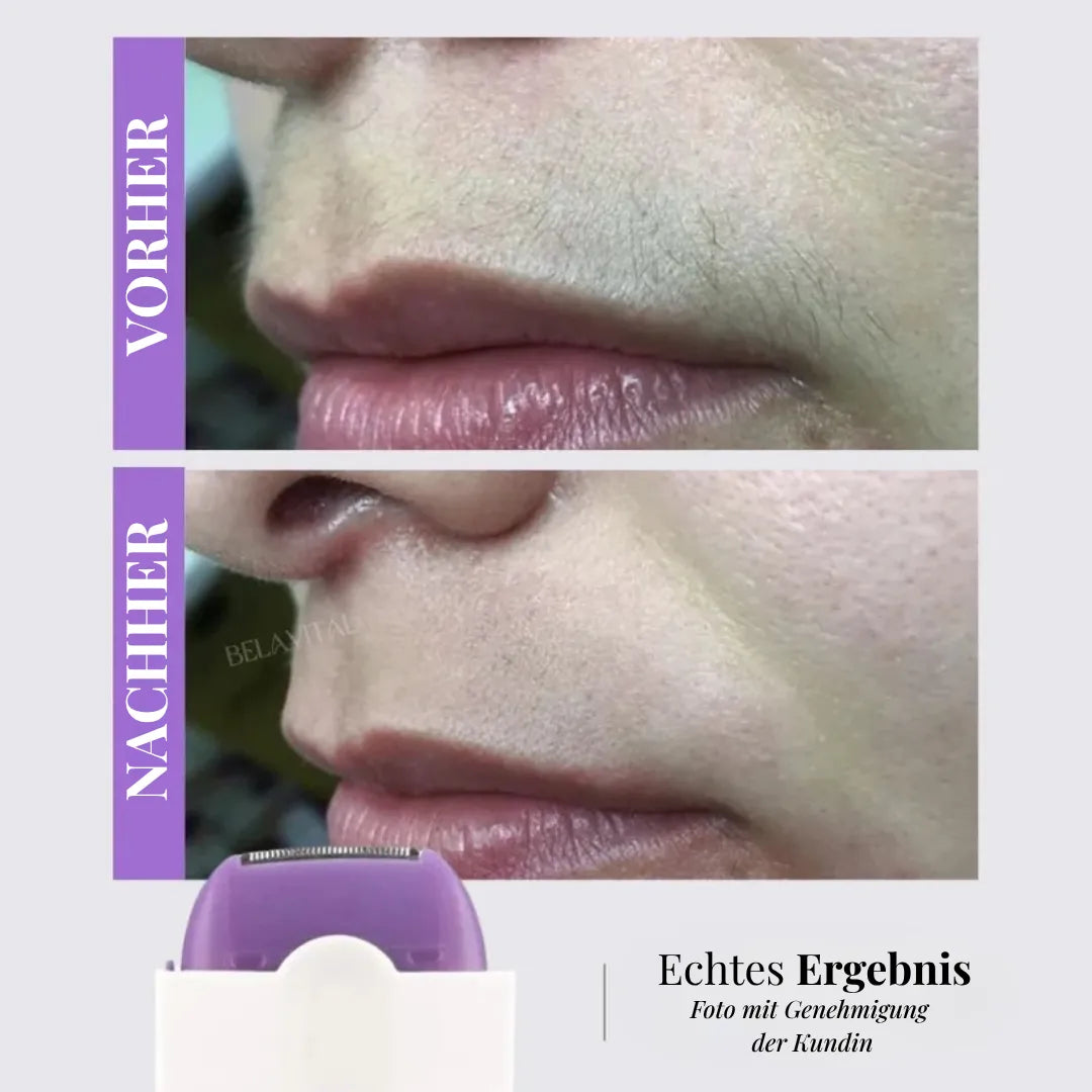 LaserFlex Haarentferner – Schmerzfreie Depilation + Gratisgeschenk