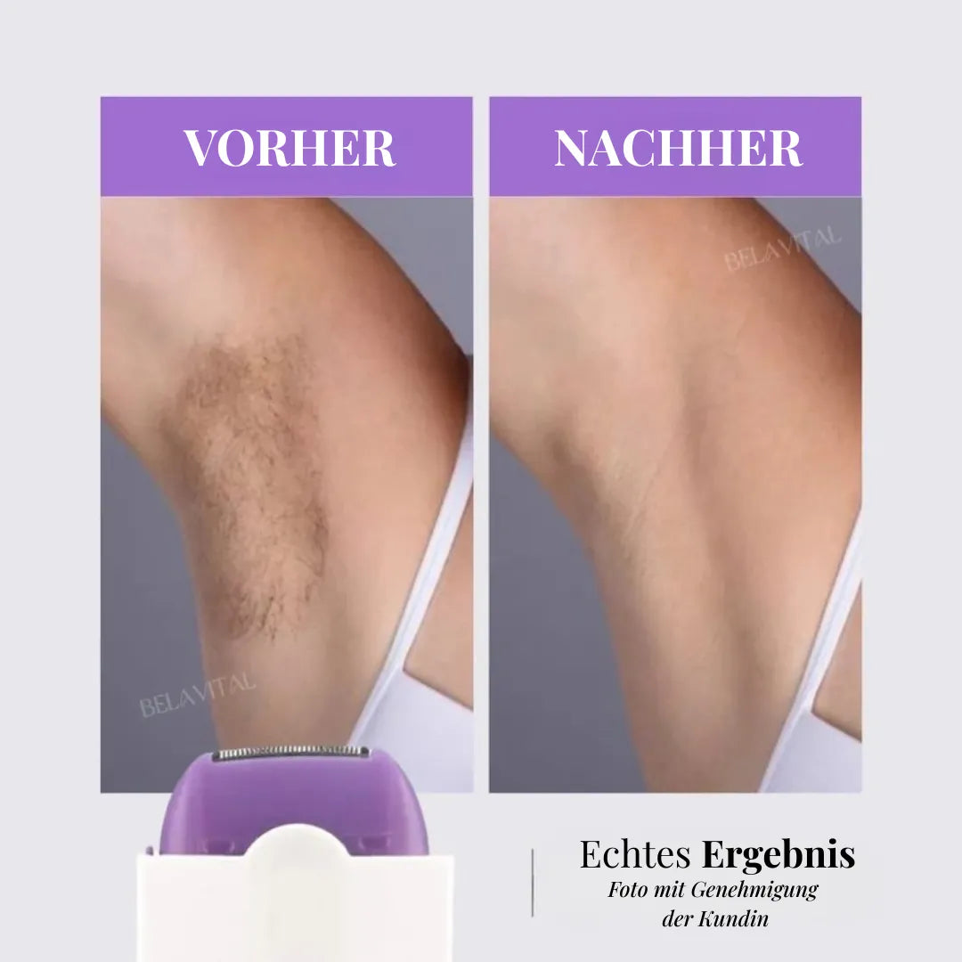 LaserFlex Haarentferner – Schmerzfreie Depilation + Gratisgeschenk