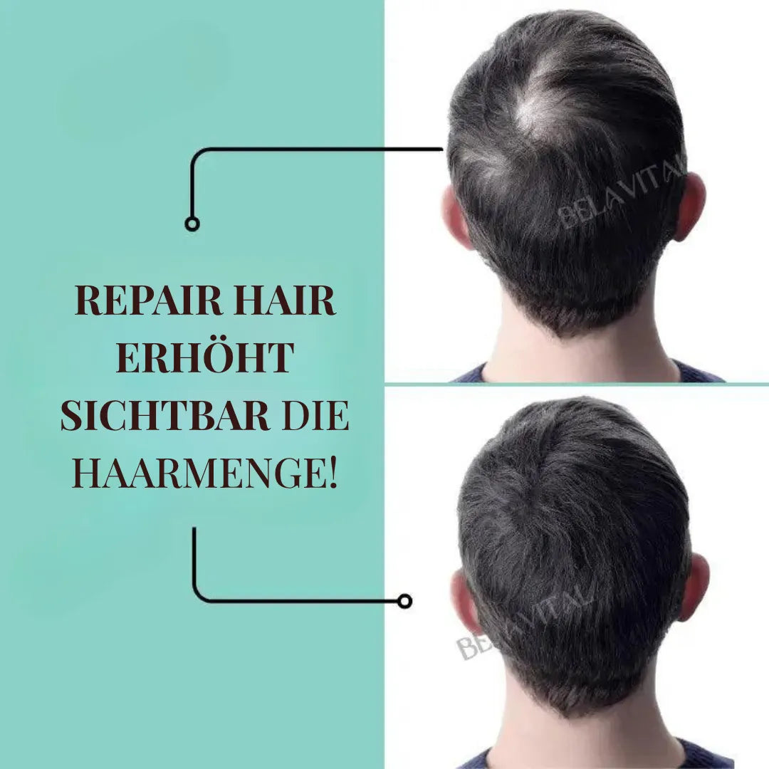 Repair Hair Pro+ Set mit Gratisgeschenk: Die Komplettlösung gegen Haarausfall und beginnende Glatze