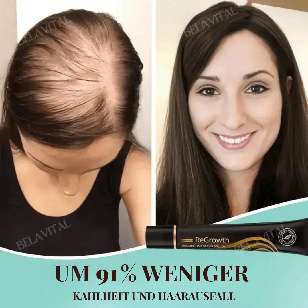 Repair Hair Pro+ Set mit Gratisgeschenk: Die Komplettlösung gegen Haarausfall und beginnende Glatze