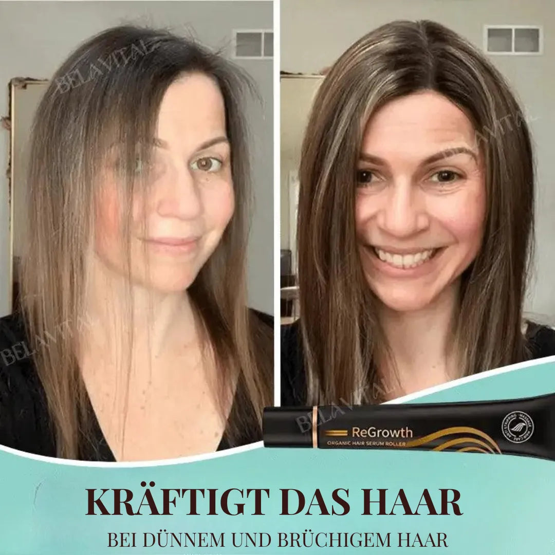 Repair Hair Pro+ Set mit Gratisgeschenk: Die Komplettlösung gegen Haarausfall und beginnende Glatze