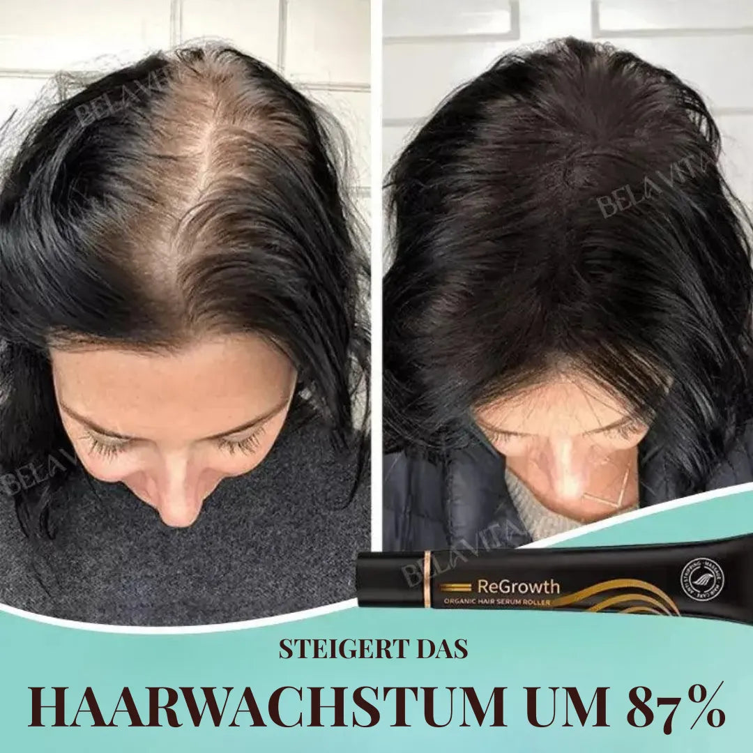 Repair Hair Pro+ Set mit Gratisgeschenk: Die Komplettlösung gegen Haarausfall und beginnende Glatze