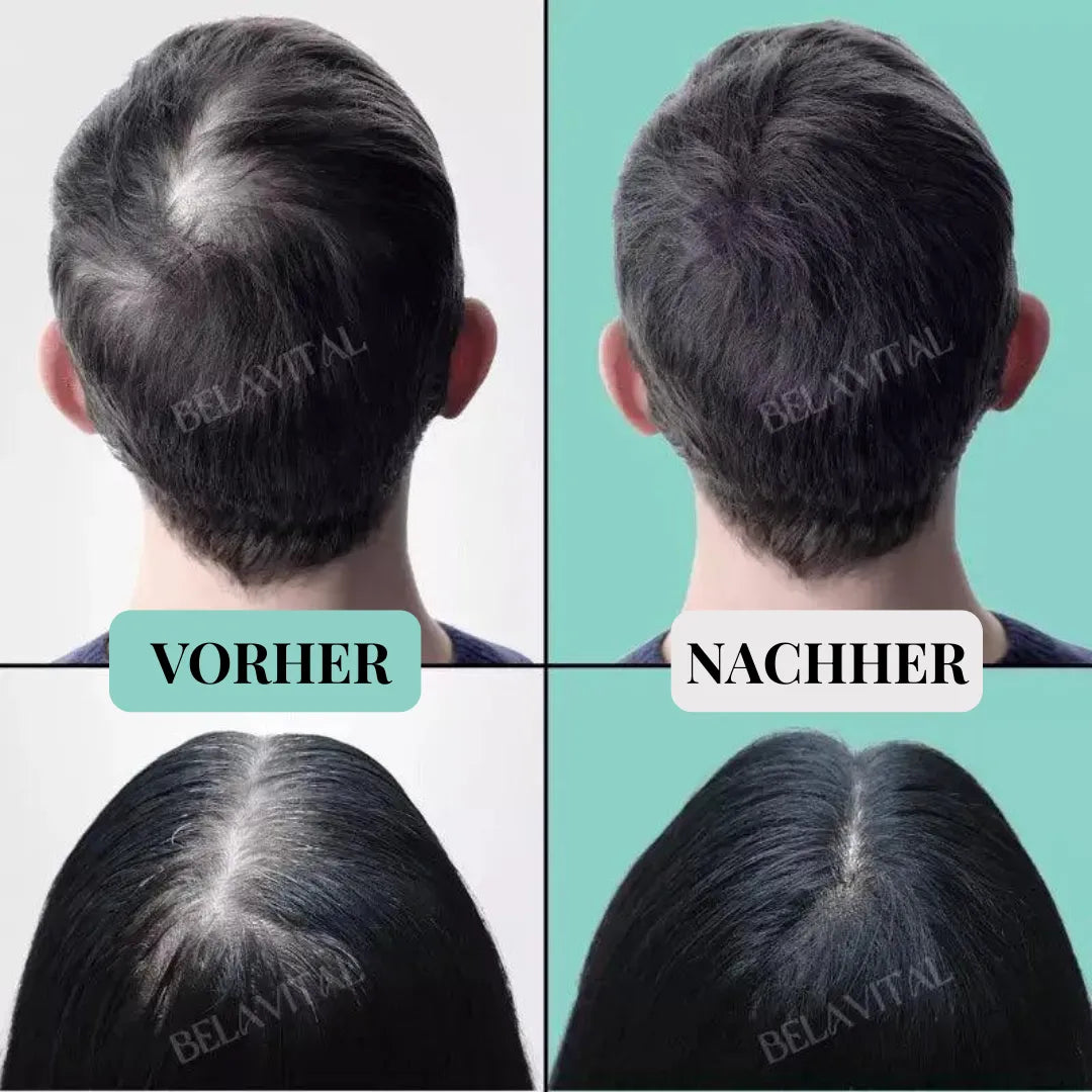 Repair Hair Pro+ Set mit Gratisgeschenk: Die Komplettlösung gegen Haarausfall und beginnende Glatze