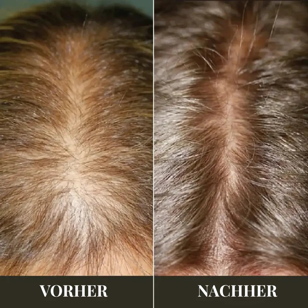 Rosmarin-Öl: Natürliches Haarwachstum & Stärkung